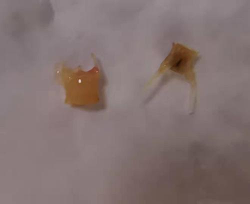 肺部糜烂！孩子吃这东西家长得看住