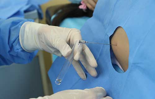 蜜桃视频
首例SMA治疗见成效