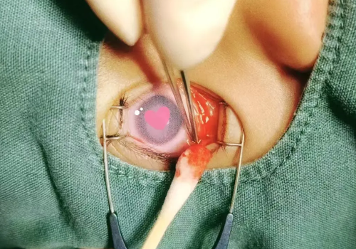 揪心！4岁男孩眼球被筷子戳伤，流血不止……