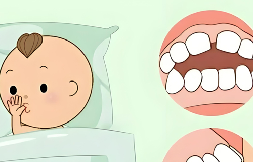 孩子吃手、嘬腮帮子！到这个程度一定要干预！